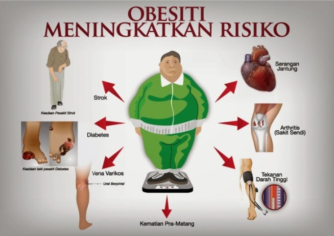 risiko obesiti